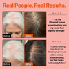 Hair Growth Serum with Massage Brush Applicator – Thickening & Hair Regrowth Scalp Treatment for Fuller, Stronger Hair